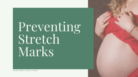 Preventing Stretch Marks